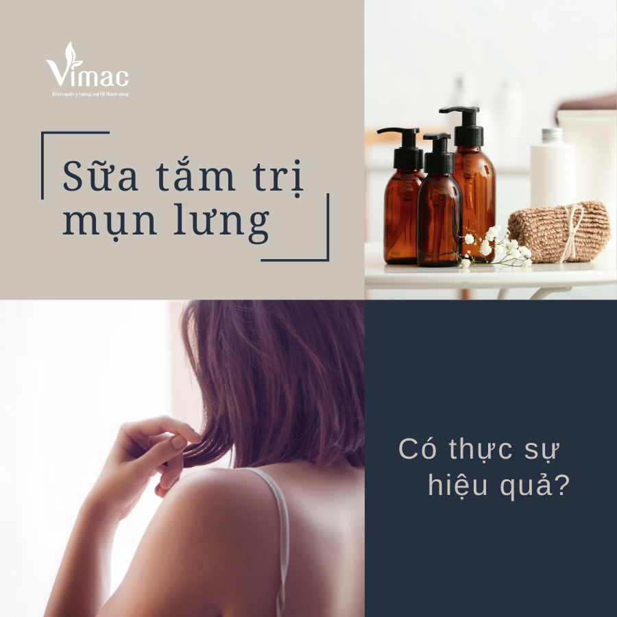 Sữa tắm trị mụn lưng 7